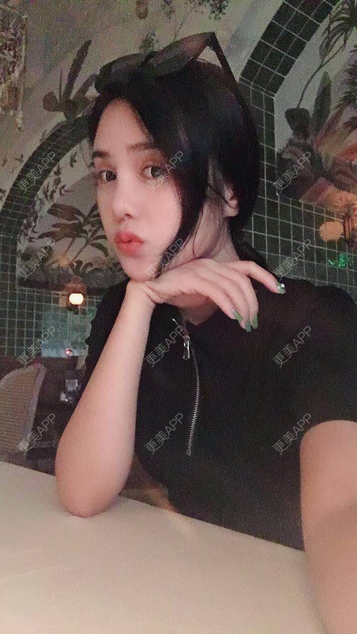 更美 - 可可柠檬的自体脂肪丰苹果肌经验 | 重庆 | 自体脂肪丰太阳穴 | 自体脂肪丰面颊 | 自体脂肪丰额头 | 自体脂肪丰苹果肌 | 自体脂肪垫下巴