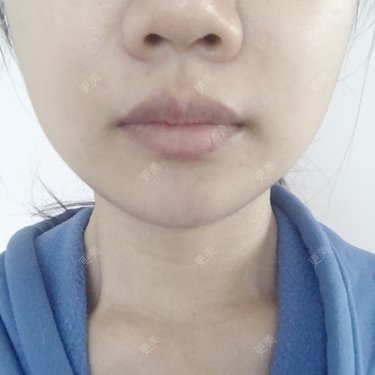 小胖兔