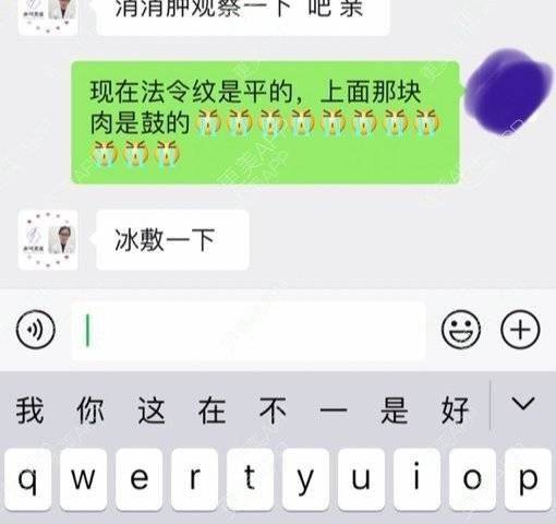 更美 - 小胖兔的玻尿酸鼻部经验 | 玻尿酸鼻部 | 天津 | 玻尿酸鼻基底
