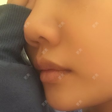 小胖兔