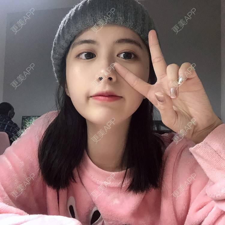 更美 - 更美用户e3UQ3Qy244的隆鼻经验 | 视频日记 | 佛山 | 隆鼻