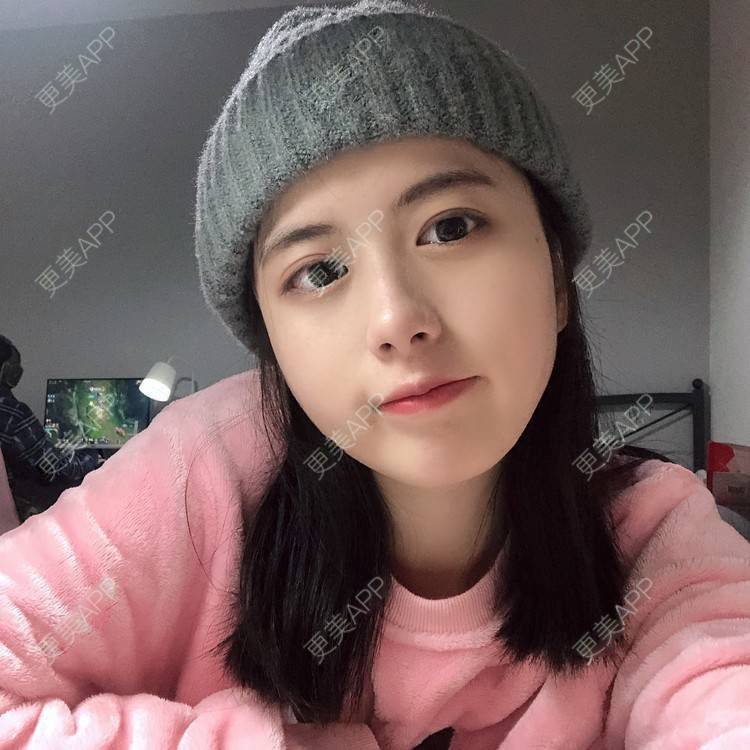 更美 - 更美用户e3UQ3Qy244的隆鼻经验 | 视频日记 | 佛山 | 隆鼻