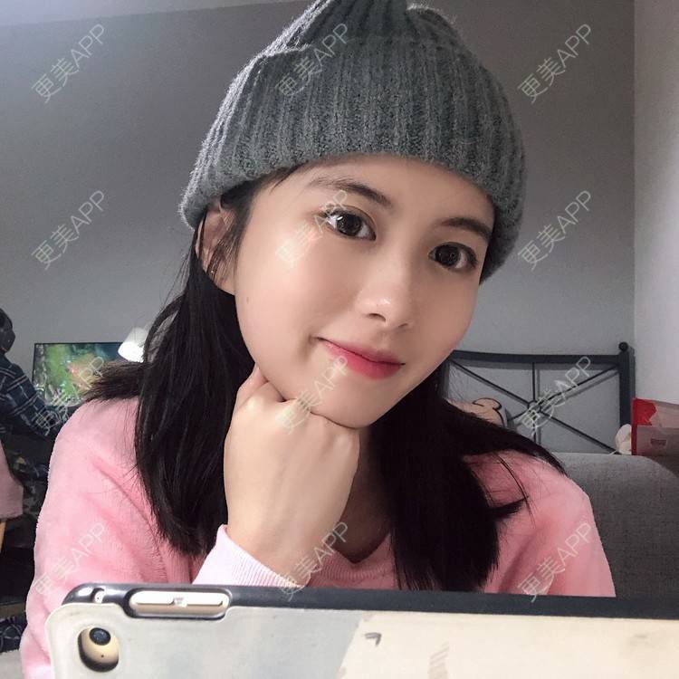 更美 - 更美用户e3UQ3Qy244的隆鼻经验 | 视频日记 | 佛山 | 隆鼻