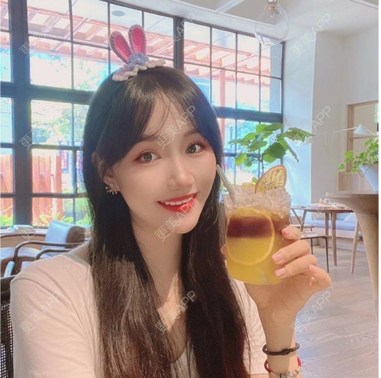 更美 - 努力变美123123的除皱瘦脸经验 | 除皱瘦脸 | 苏州