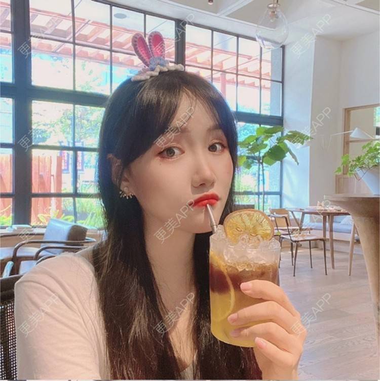 更美 - 努力变美123123的除皱瘦脸经验 | 除皱瘦脸 | 苏州