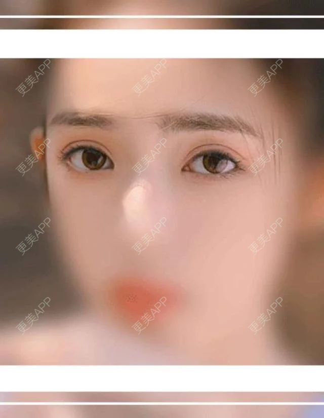 更美 - 更美用户7clzh57ByI的洗牙套餐经验 | 南京 | 洗牙套餐