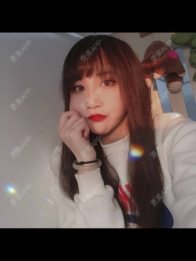 更美 - 更美用户hpUUyPQazb的上下颚手术经验 | 上海 | 上下颚手术