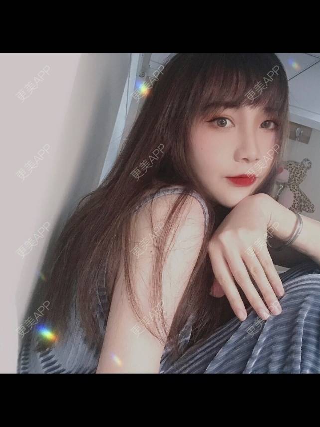 更美 - 更美用户hpUUyPQazb的上下颚手术经验 | 上海 | 上下颚手术