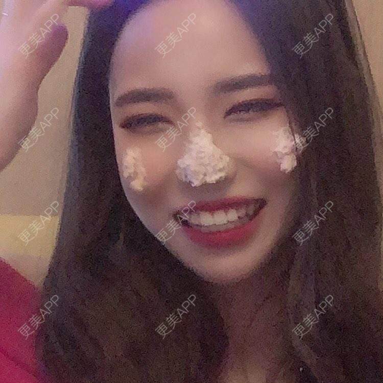 更美 - 更美用户rdIY6kSiwU的皓齿美白经验 | 皓齿美白 | 冷光美白 | 深圳