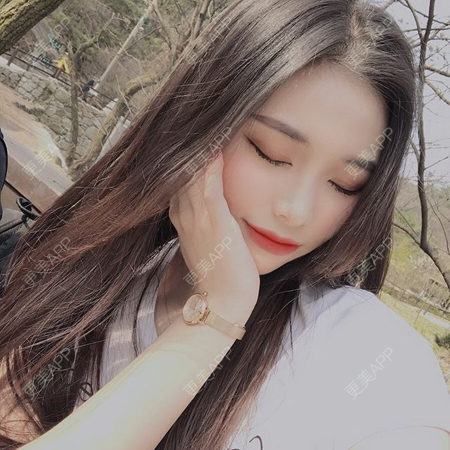 更美 - 更美用户rdIY6kSiwU的皓齿美白经验 | 皓齿美白 | 冷光美白 | 深圳