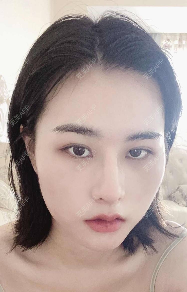 更美 - ヌ酷还可爱ˇ男的鼻部多项经验 | 鼻部多项 | 重庆