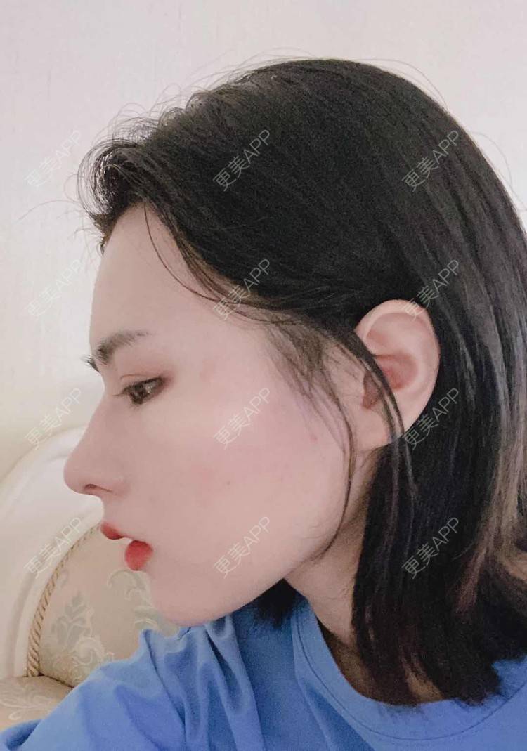 更美 - ヌ酷还可爱ˇ男的鼻部多项经验 | 鼻部多项 | 重庆