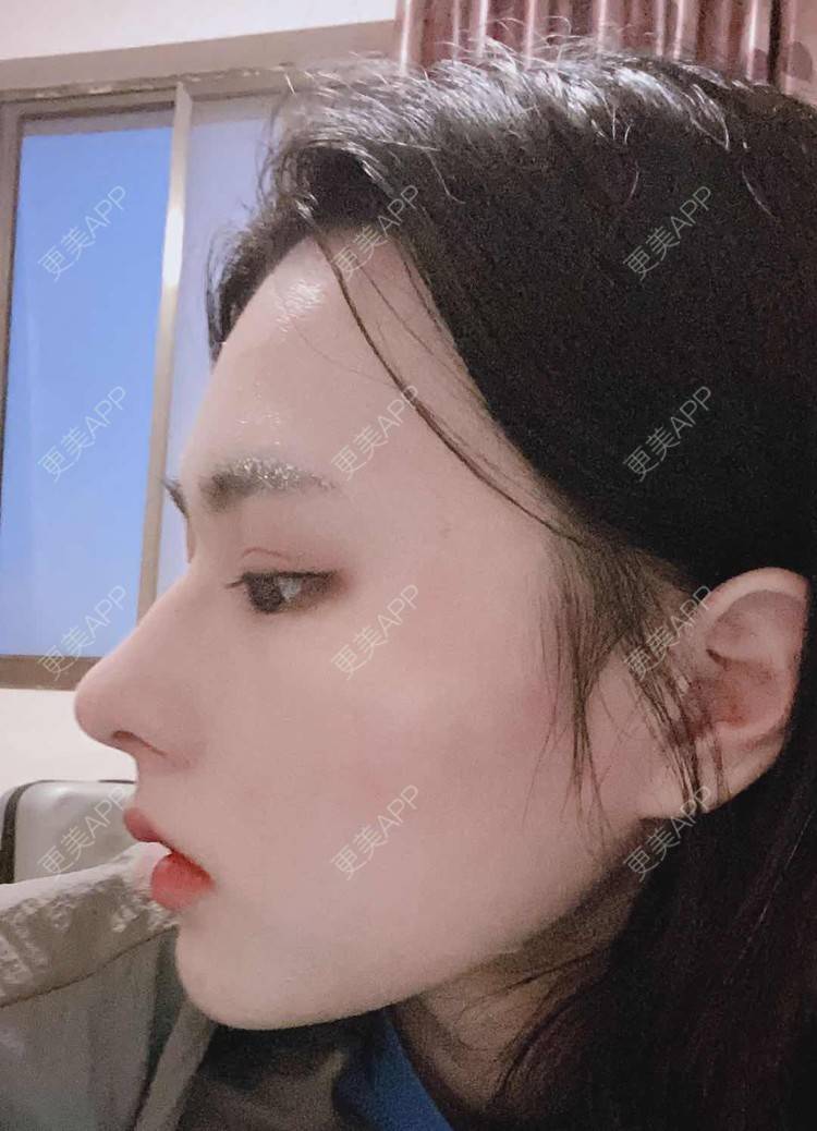 更美 - ヌ酷还可爱ˇ男的鼻部多项经验 | 鼻部多项 | 重庆