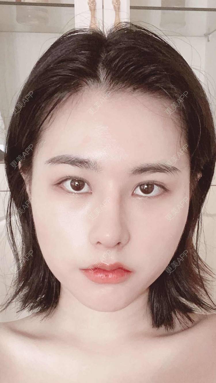 更美 - ヌ酷还可爱ˇ男的鼻部多项经验 | 鼻部多项 | 重庆