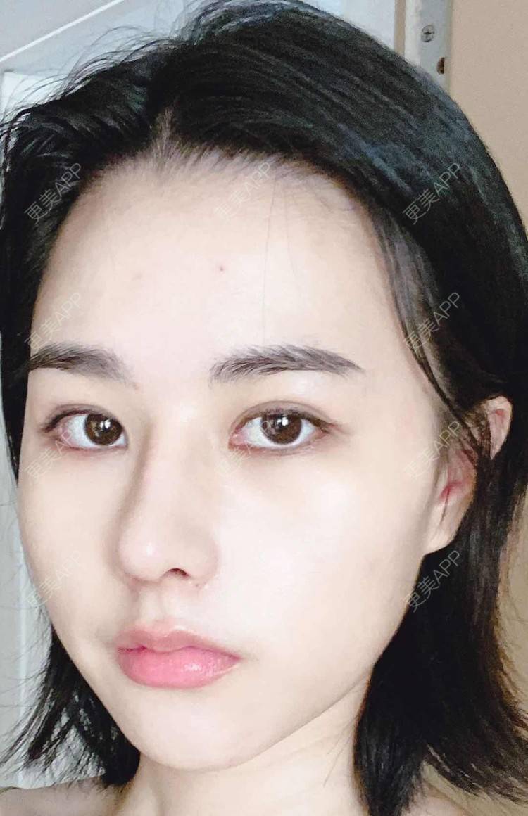 更美 - ヌ酷还可爱ˇ男的鼻部多项经验 | 鼻部多项 | 重庆