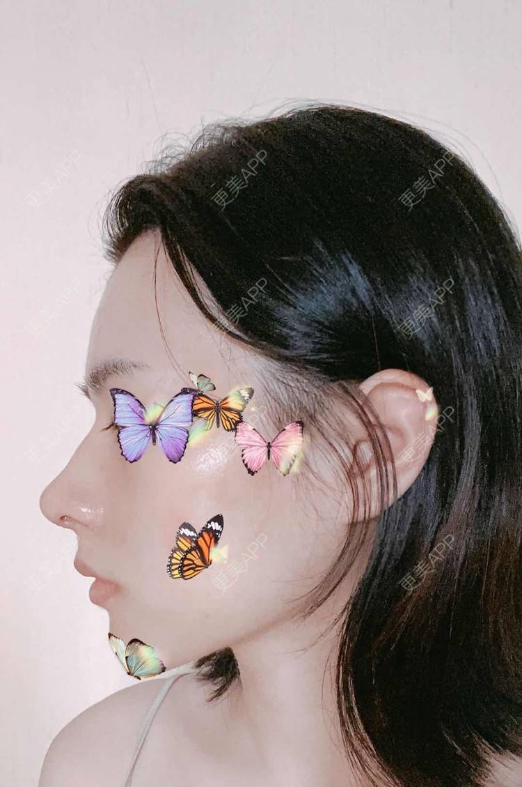 更美 - ヌ酷还可爱ˇ男的鼻部多项经验 | 鼻部多项 | 重庆