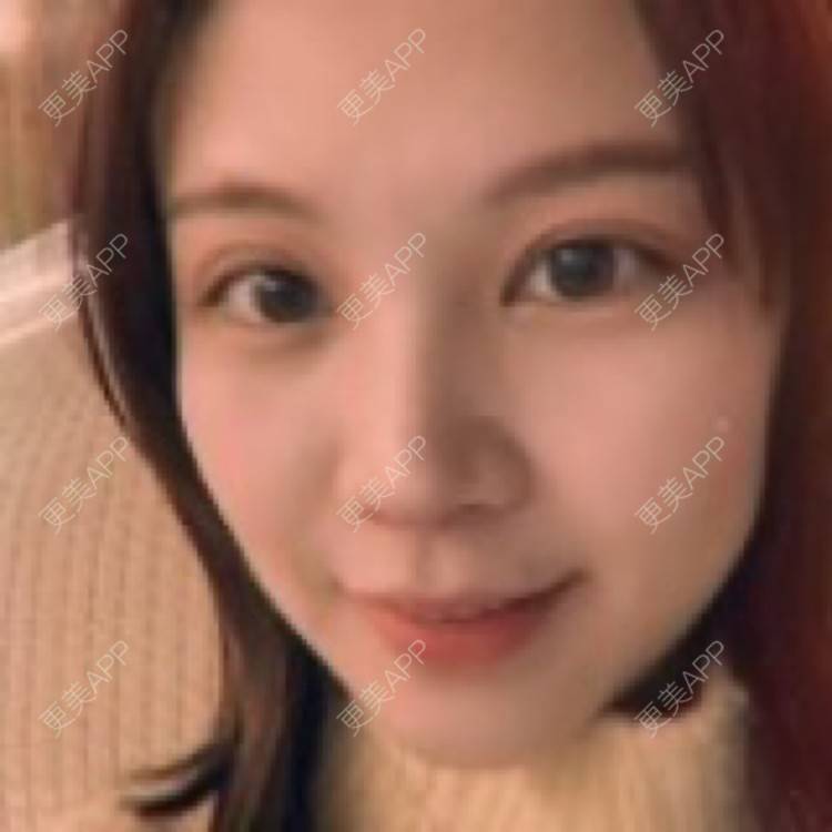 更美 - 更美用户VvNgZlCAZx的胶原蛋白淡化黑眼圈经验 | 杭州 | 胶原蛋白淡化黑眼圈