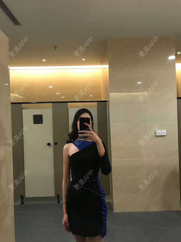 更美 - 更美用户rRiqiy6IDF的眼部多项经验 | 眼部多项 | 广州