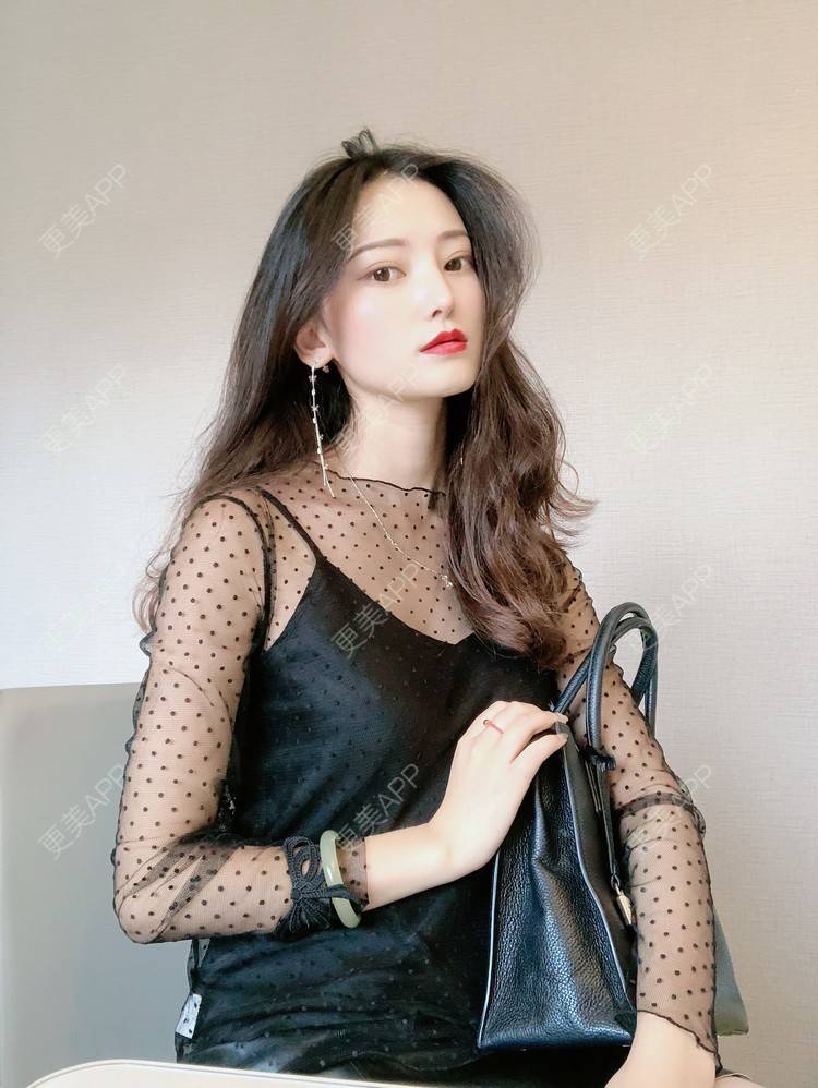 更美 - 行▍24°温暧。.的下颌角整形经验 | 颧骨内推 | 颧骨提高 | 轮廓修复术 | 颧弓降低 | 下颌角切除 | 颧骨颧弓整形 | 下颌角整形 | 视频日记 | 成都