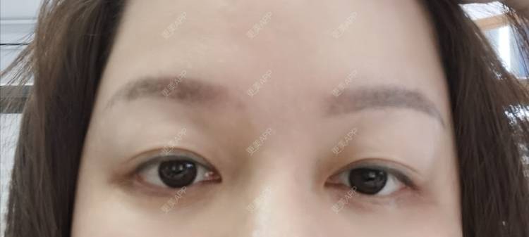 更美 - baoXbao的皮秒激光经验 | 皮秒激光