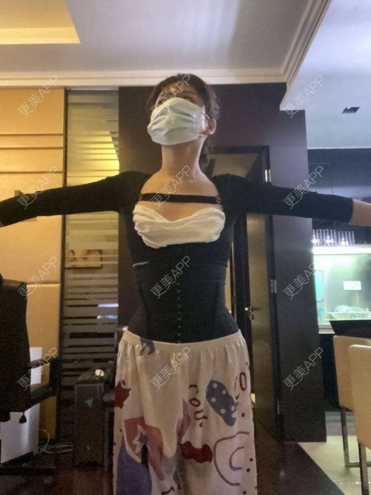 更美 - 更美用户KeZigsBQ7k的射频溶脂瘦手臂经验 | 广州 | 射频溶脂瘦手臂