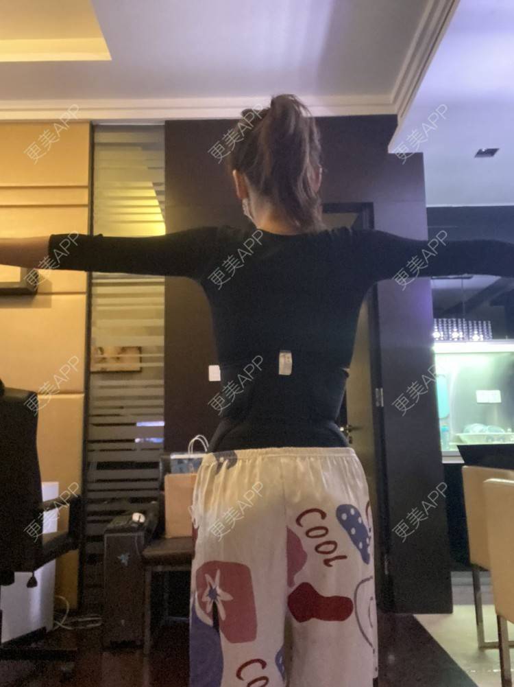 更美 - 更美用户KeZigsBQ7k的射频溶脂瘦手臂经验 | 广州 | 射频溶脂瘦手臂