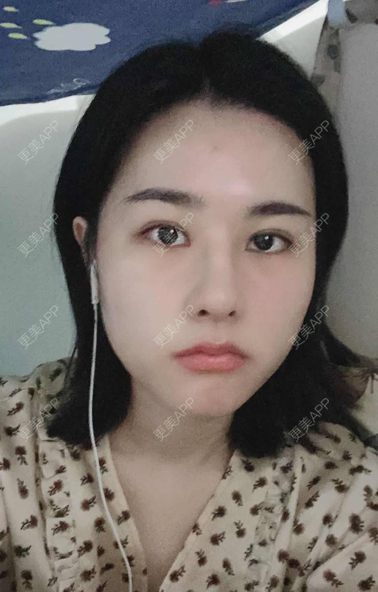 更美 - ヌ酷还可爱ˇ男的鼻部多项经验 | 鼻部多项 | 重庆