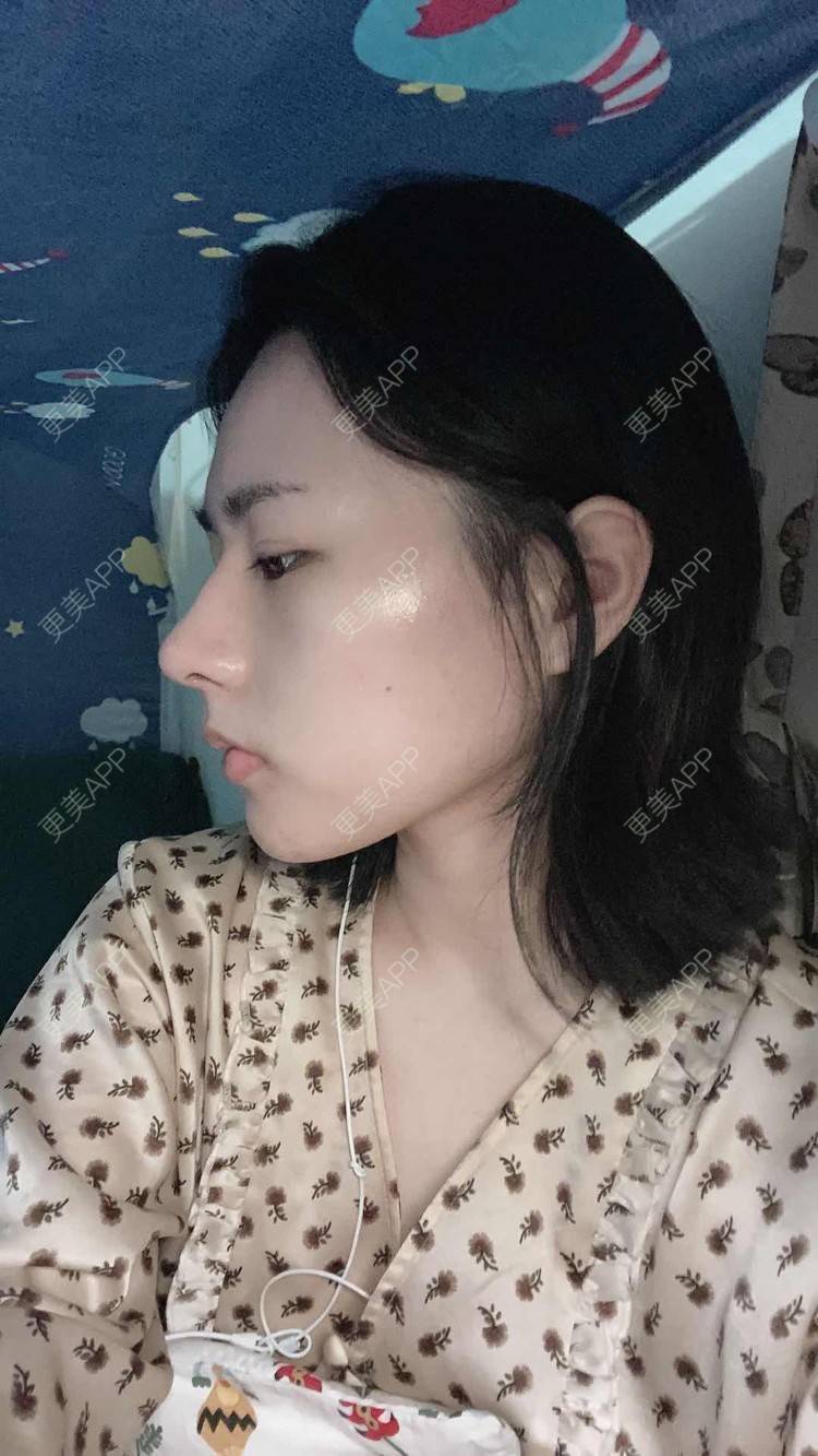 更美 - ヌ酷还可爱ˇ男的鼻部多项经验 | 鼻部多项 | 重庆