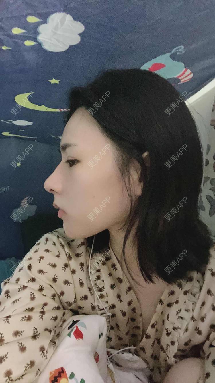 更美 - ヌ酷还可爱ˇ男的鼻部多项经验 | 鼻部多项 | 重庆