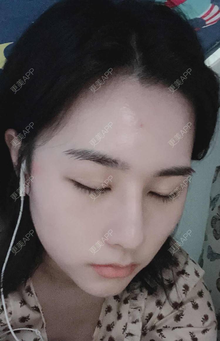 更美 - ヌ酷还可爱ˇ男的鼻部多项经验 | 鼻部多项 | 重庆