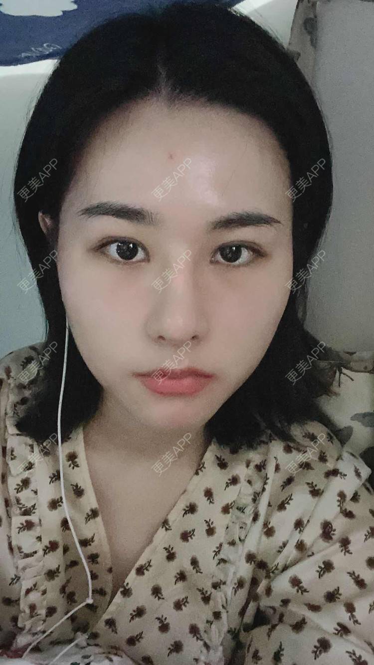 更美 - ヌ酷还可爱ˇ男的鼻部多项经验 | 鼻部多项 | 重庆