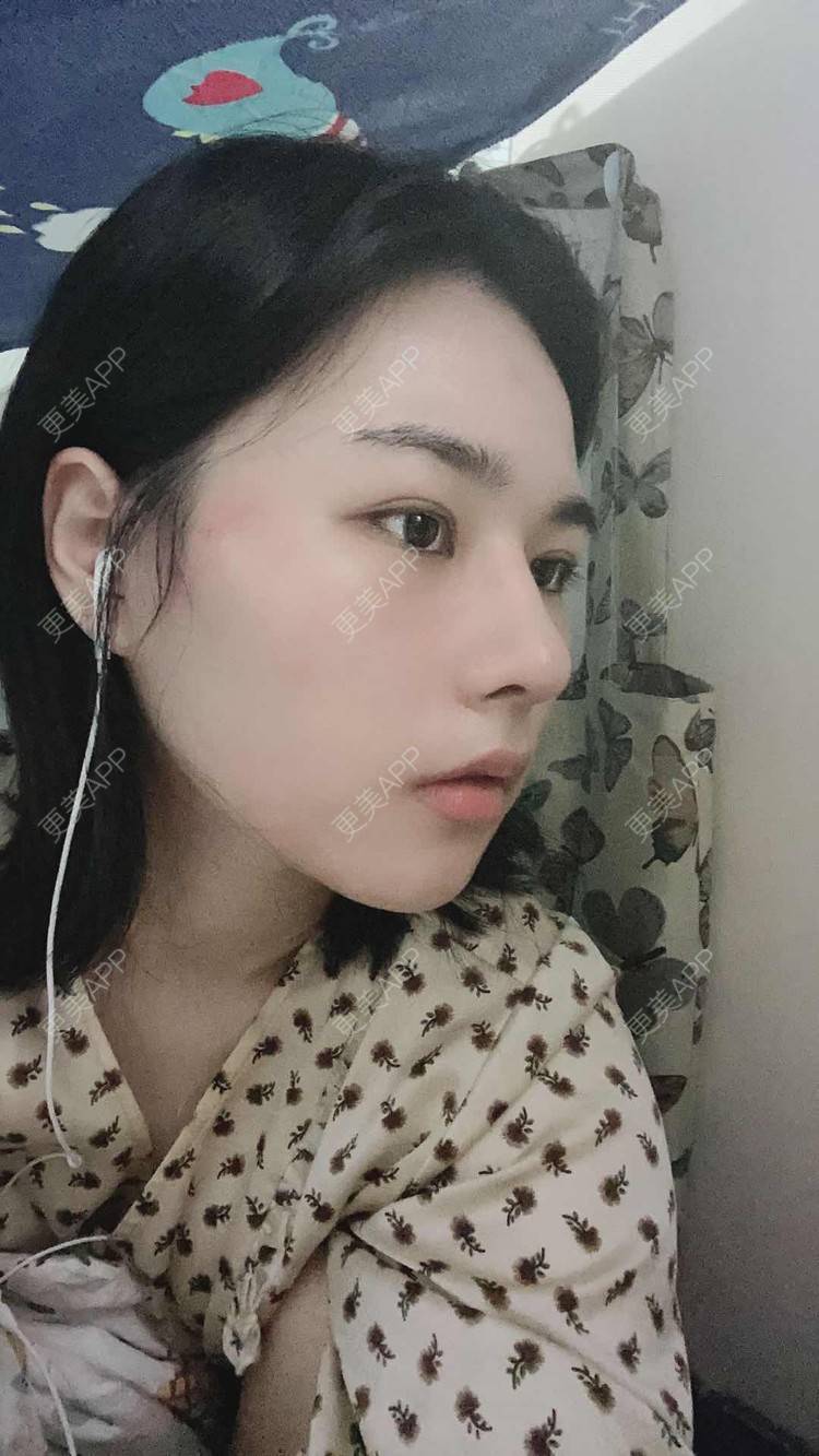 更美 - ヌ酷还可爱ˇ男的鼻部多项经验 | 鼻部多项 | 重庆