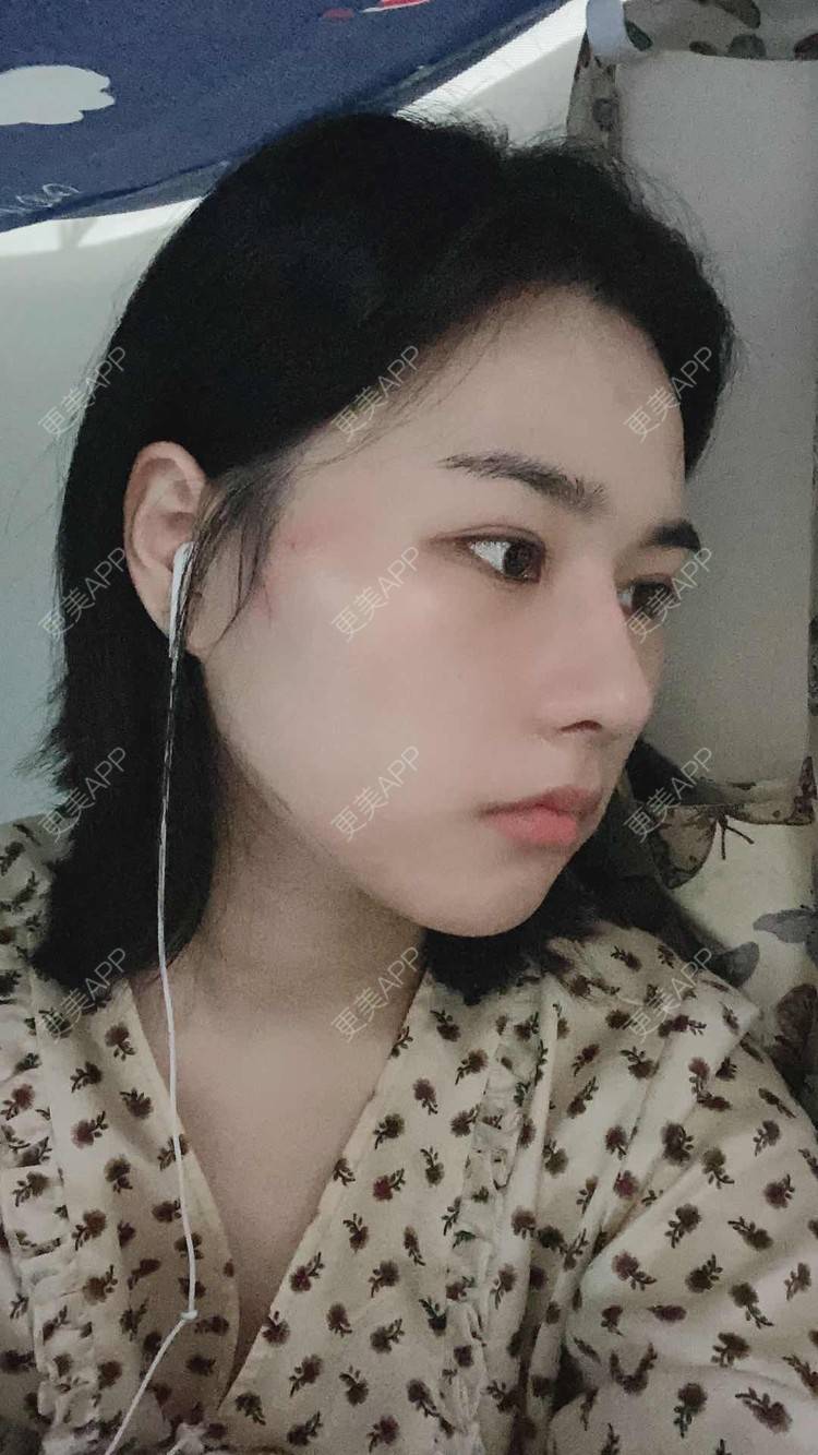 更美 - ヌ酷还可爱ˇ男的鼻部多项经验 | 鼻部多项 | 重庆