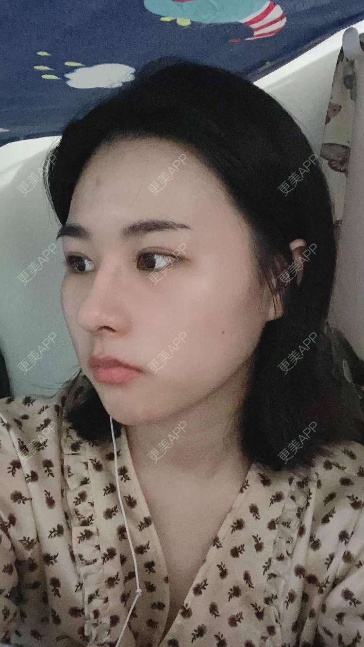 更美 - ヌ酷还可爱ˇ男的鼻部多项经验 | 鼻部多项 | 重庆