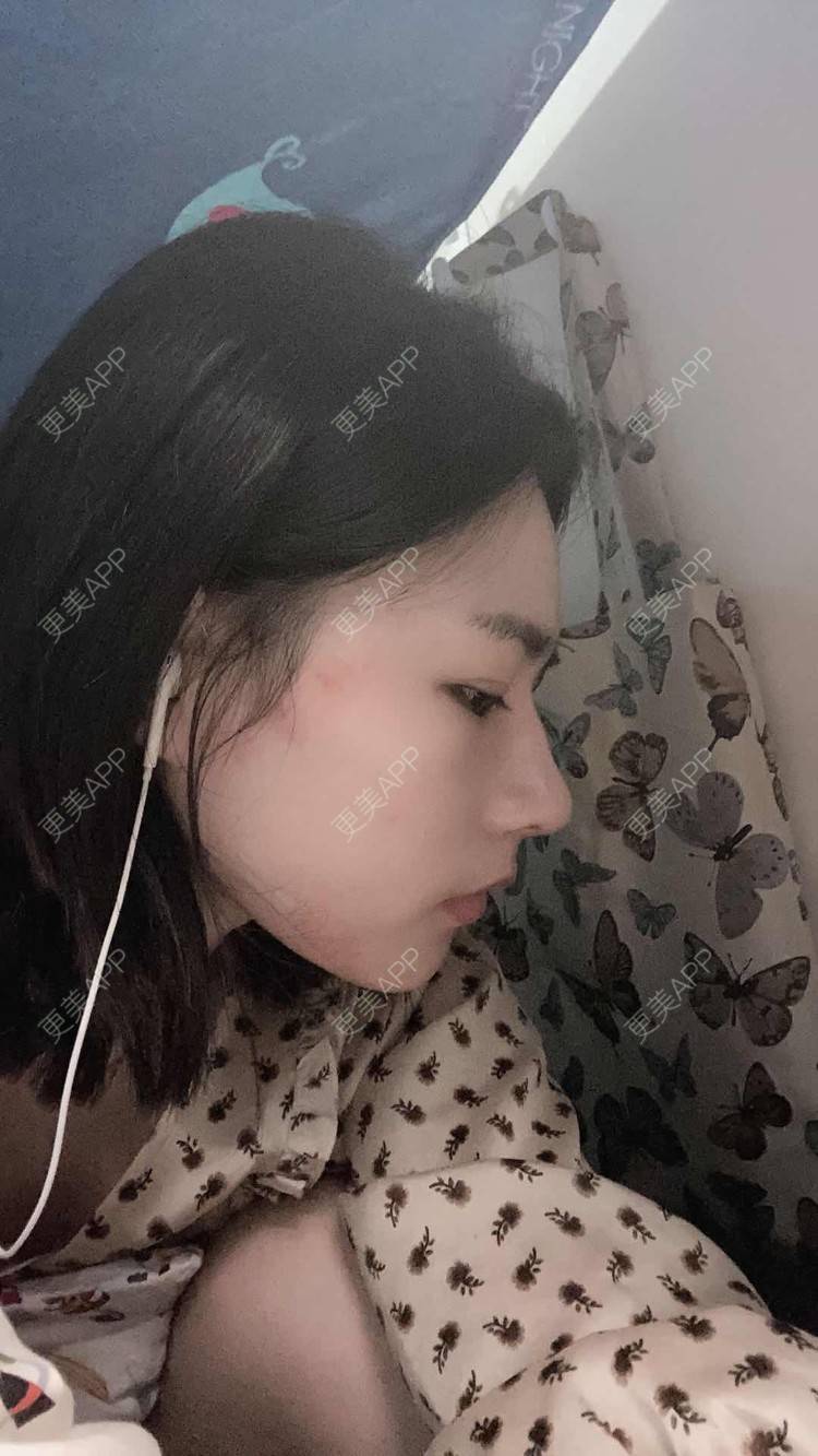 更美 - ヌ酷还可爱ˇ男的鼻部多项经验 | 鼻部多项 | 重庆