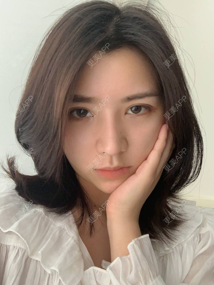 更美 - 更美用户B670A6hUBe的眼部综合经验 | 广州 | 眼部综合