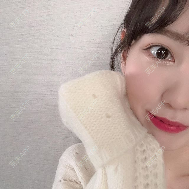 更美 - 辵近尒の墳墓灬桨的拔智齿经验 | 拔智齿 | 深圳