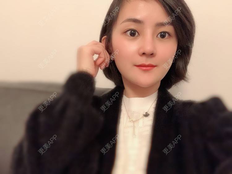 更美 - 大碴子姑娘伺的鼻部多项经验 | 鼻部多项 | 重庆