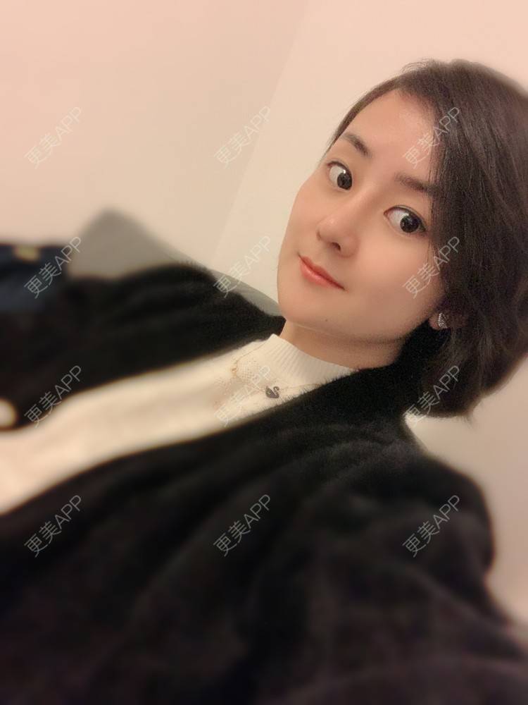 更美 - 大碴子姑娘伺的鼻部多项经验 | 鼻部多项 | 重庆