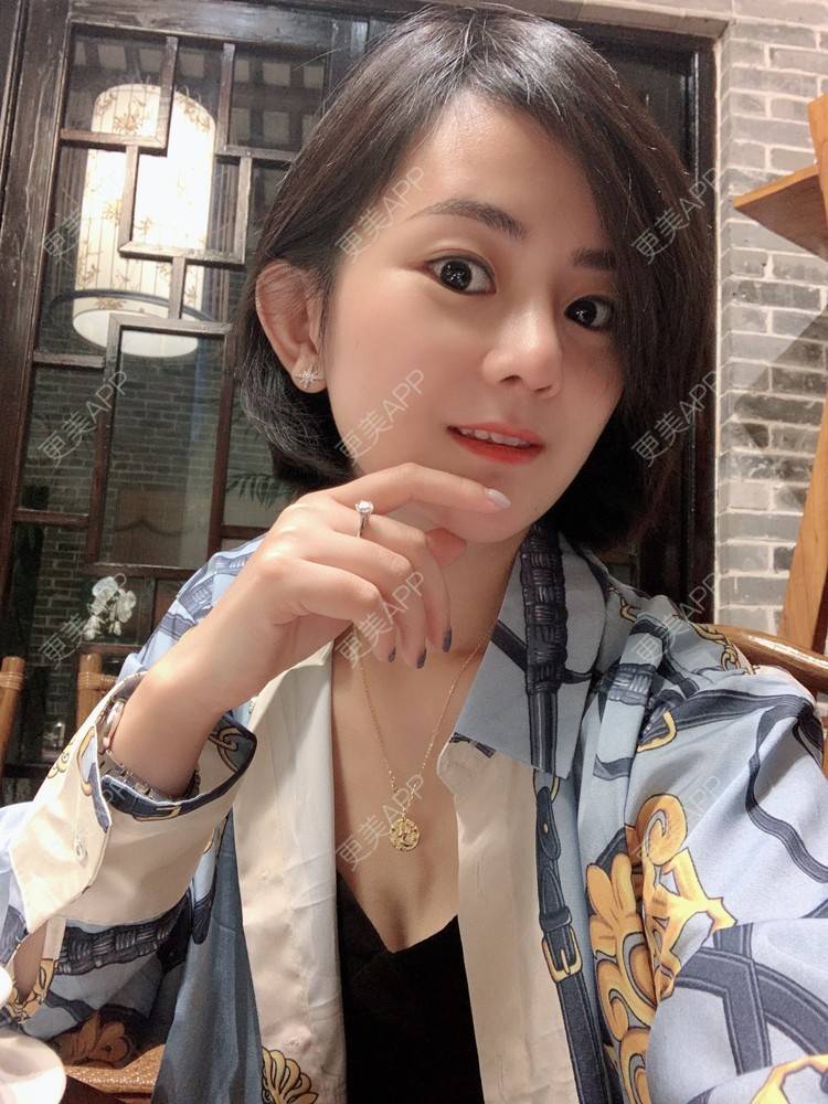 更美 - 大碴子姑娘伺的鼻部多项经验 | 鼻部多项 | 重庆