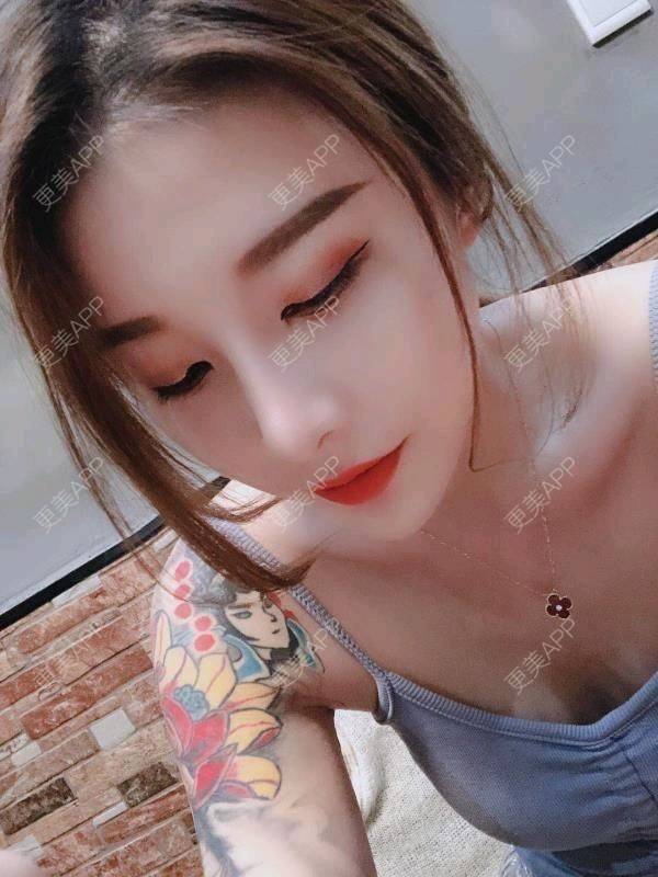 更美 - 更美用户1vYXx1pni8的隆鼻经验 | 隆鼻 | 武汉