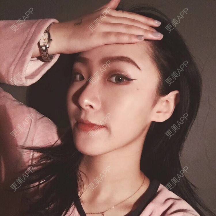 更美 - 更美用户okL6JdKOrE的隆鼻经验 | 隆鼻 | 武汉
