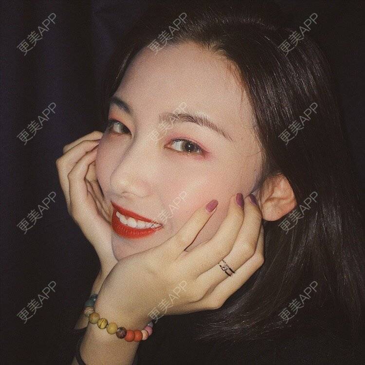 更美 - 更美用户d1wukzsloR的隆鼻经验 | 隆鼻 | 武汉