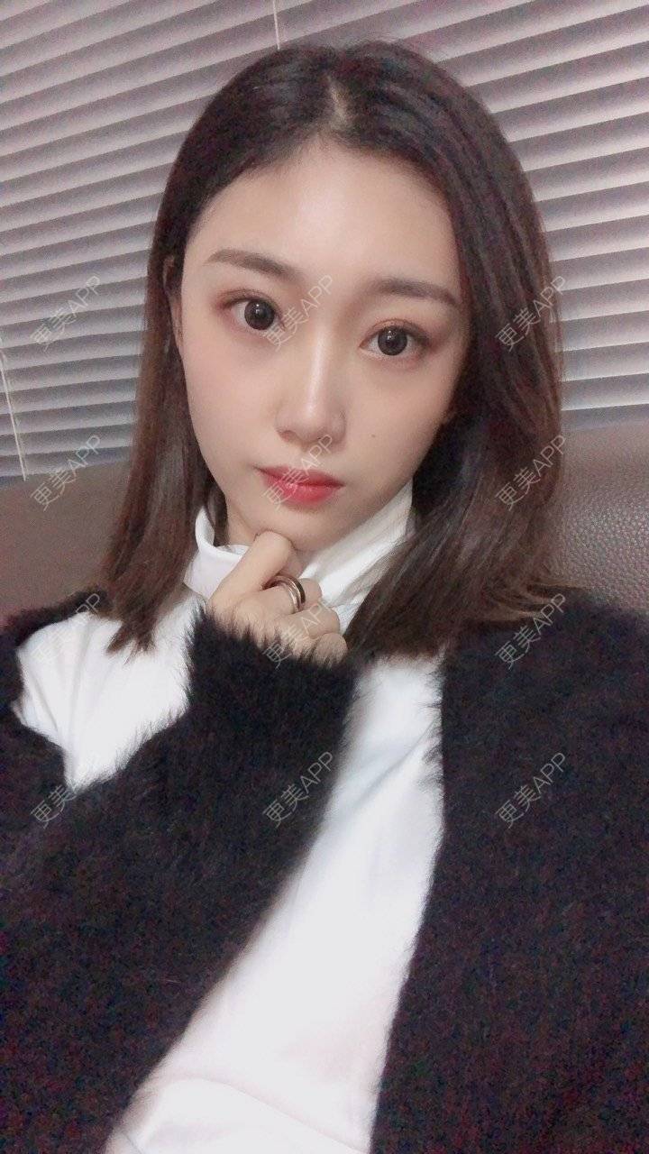 更美 - 更美用户BKmN3OzE6H的隆鼻经验 | 隆鼻 | 武汉