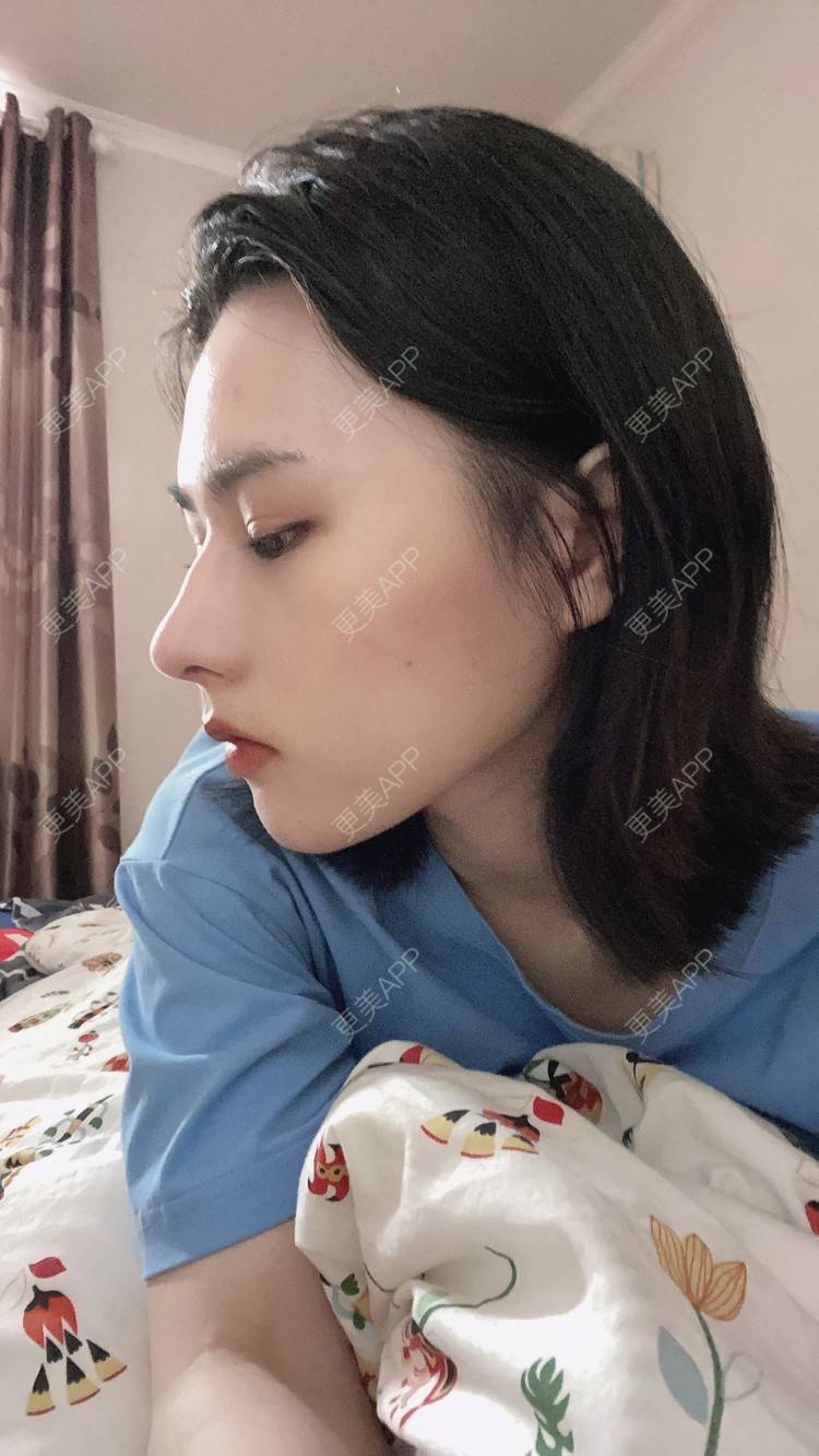 更美 - ヌ酷还可爱ˇ男的鼻部多项经验 | 鼻部多项 | 重庆