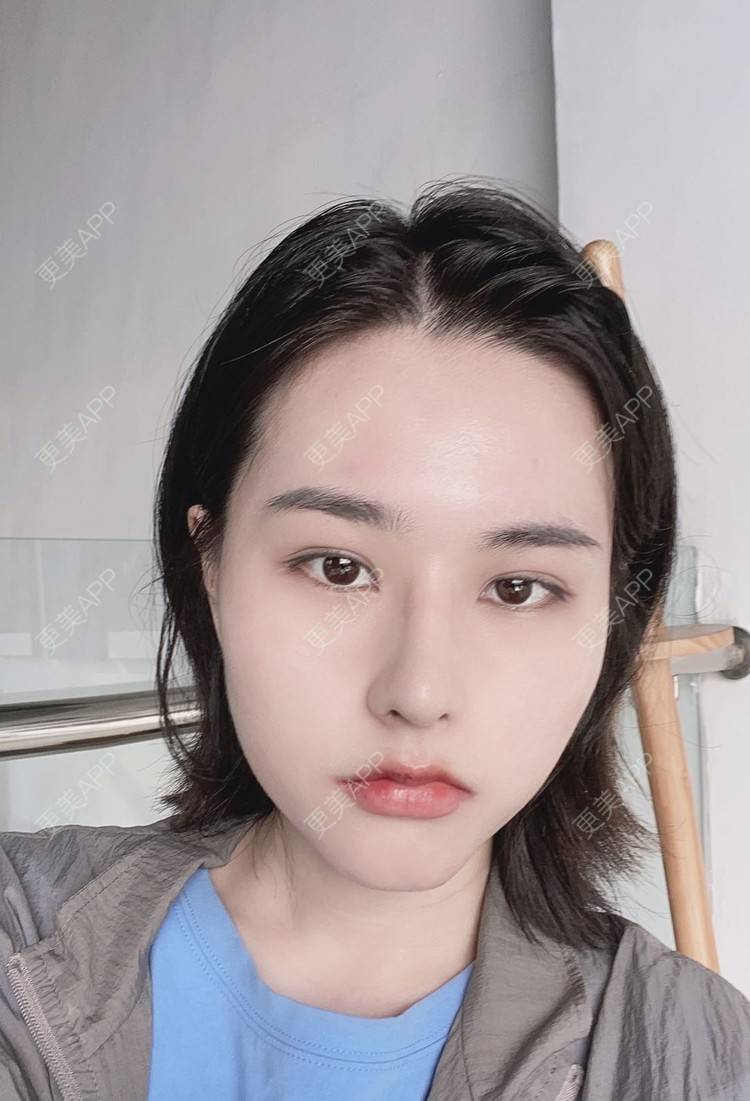 更美 - ヌ酷还可爱ˇ男的鼻部多项经验 | 鼻部多项 | 重庆