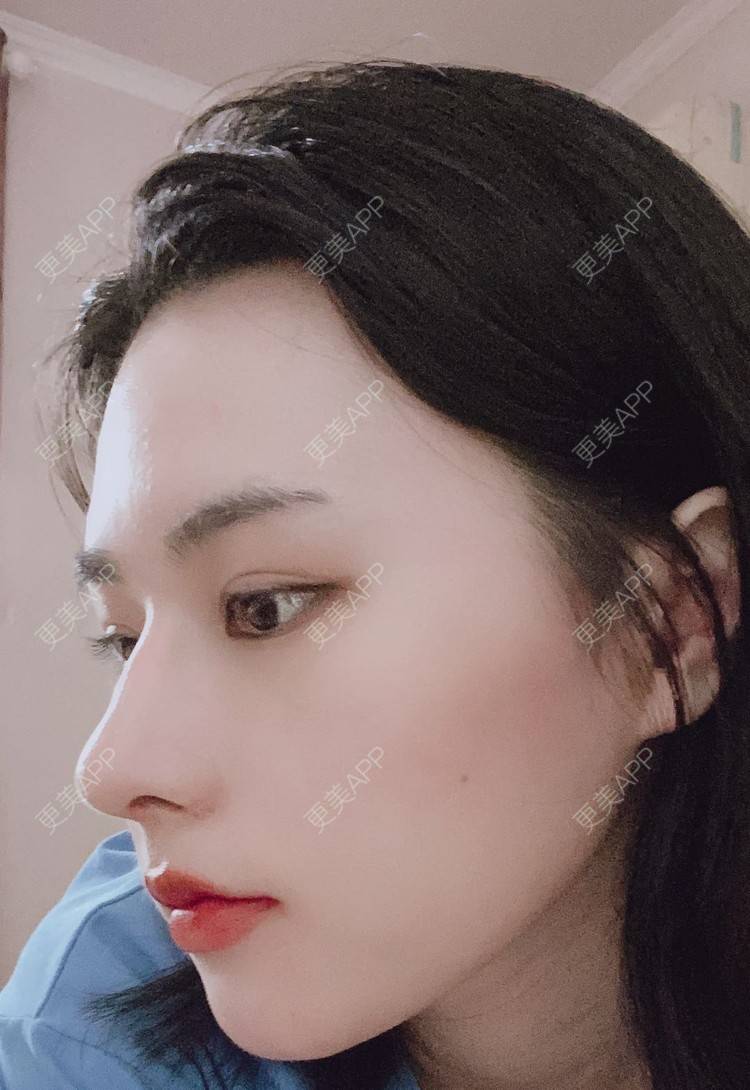 更美 - ヌ酷还可爱ˇ男的鼻部多项经验 | 鼻部多项 | 重庆