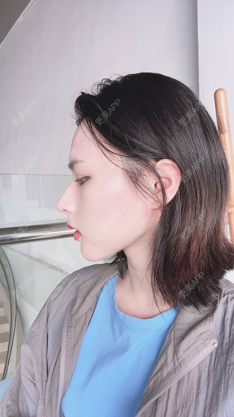 更美 - ヌ酷还可爱ˇ男的鼻部多项经验 | 鼻部多项 | 重庆