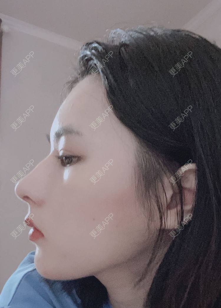 更美 - ヌ酷还可爱ˇ男的鼻部多项经验 | 鼻部多项 | 重庆