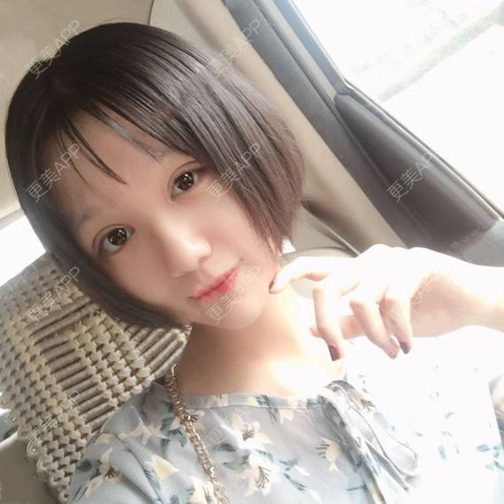 更美 - 更美用户QhVYqz6e5S的双眼皮经验 | 上海 | 双眼皮